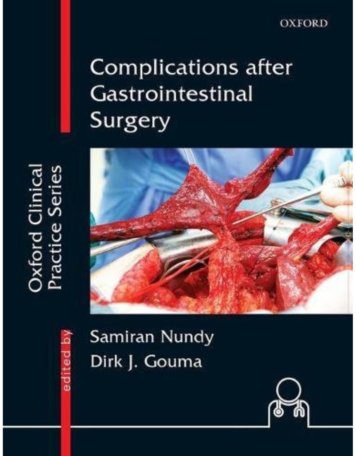 Complications after Gastrointestinal Surgery