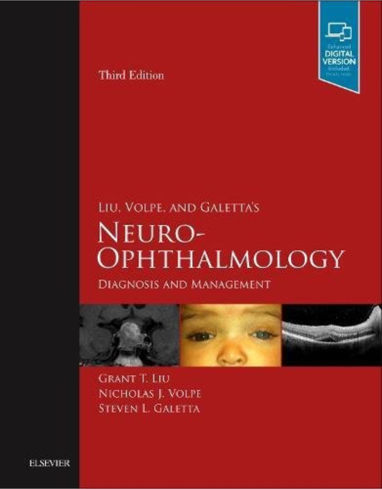 Liu, Volpe, and Galetta's Neuro-Ophthalmology: Diagnosis and Management, 3e