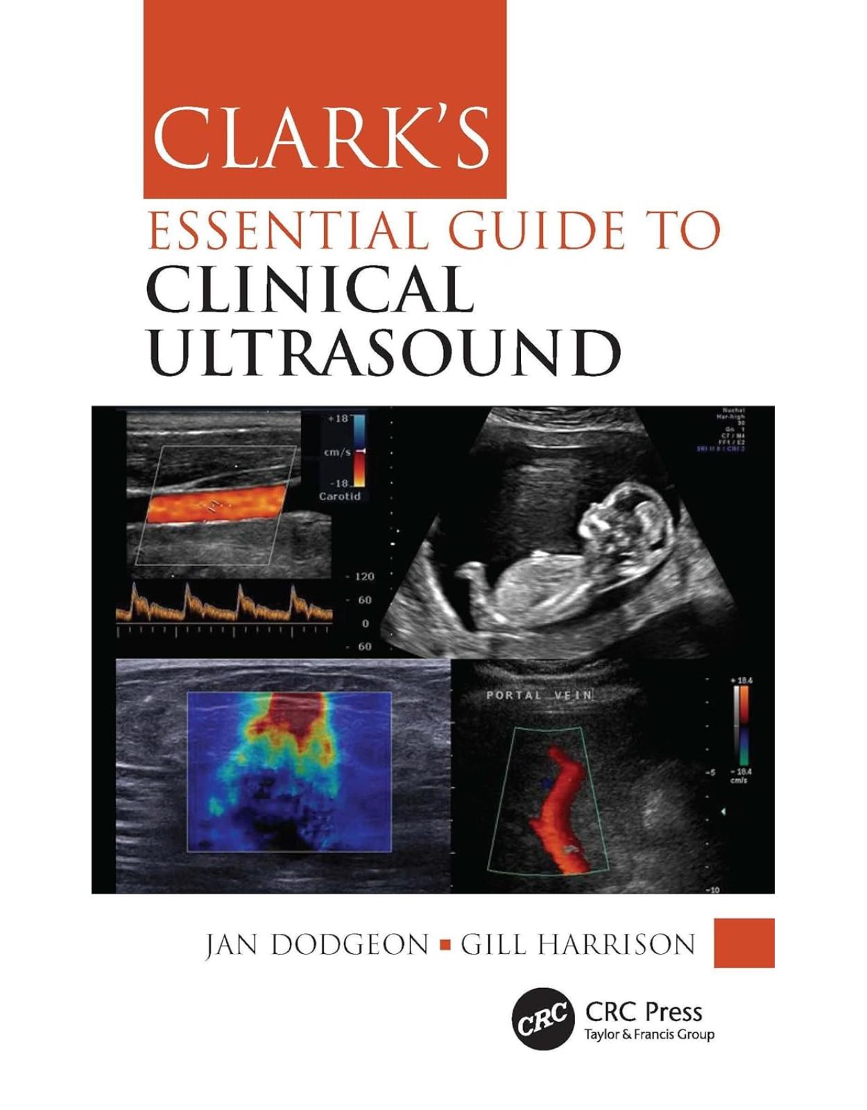 Clark’s Essential Guide to Clinical Ultrasound 