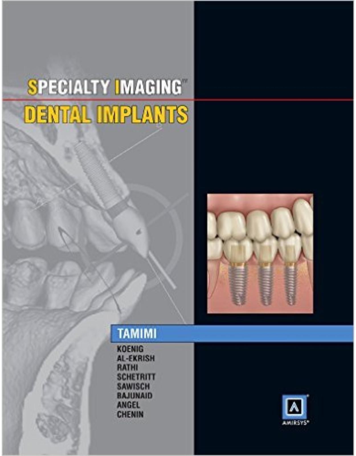 Specialty Imaging: Dental Implants, 1e