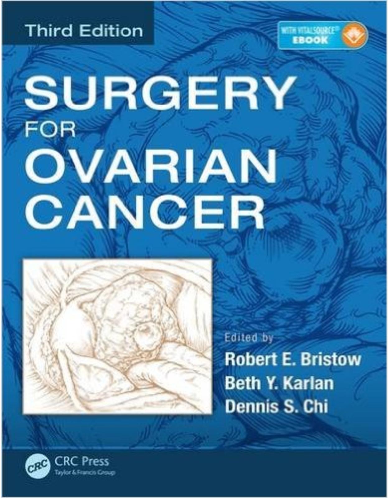 Surgery for Ovarian Cancer, Third Edition