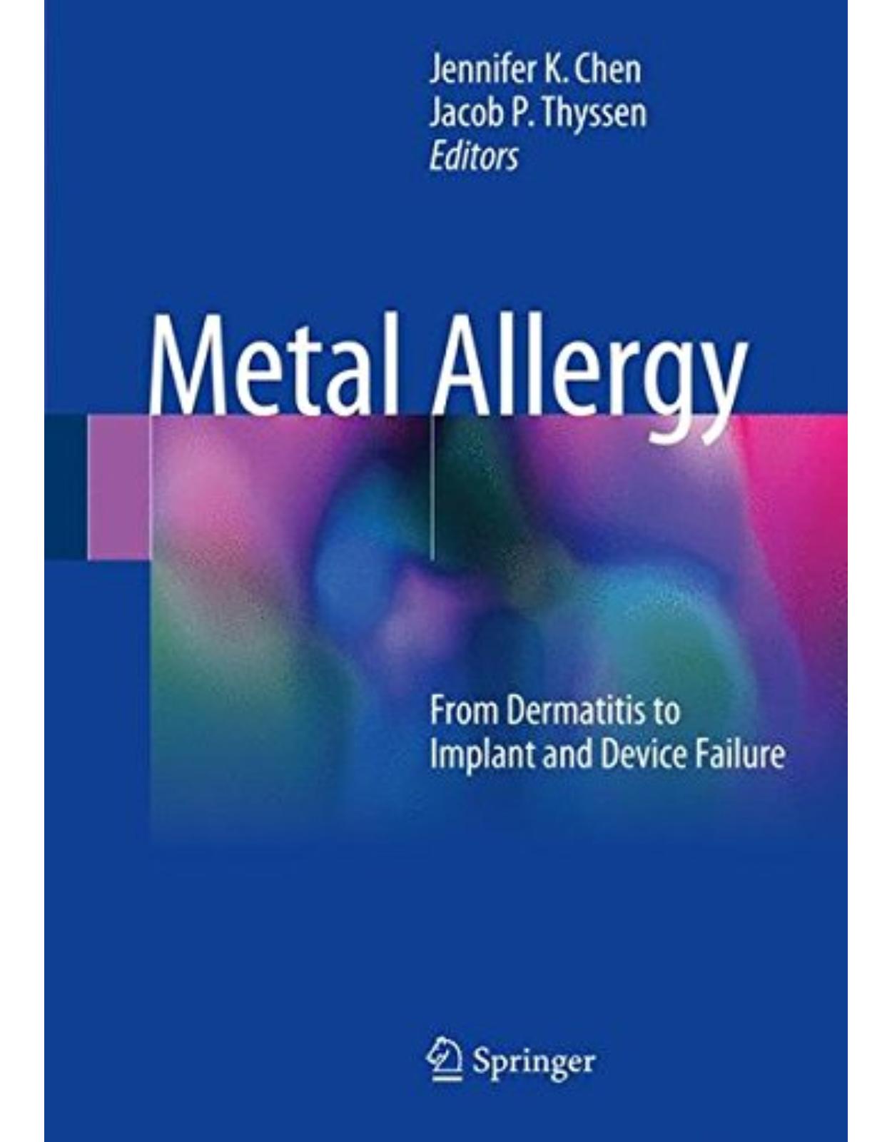 Metal Allergy: From Dermatitis to Implant and Device Failure