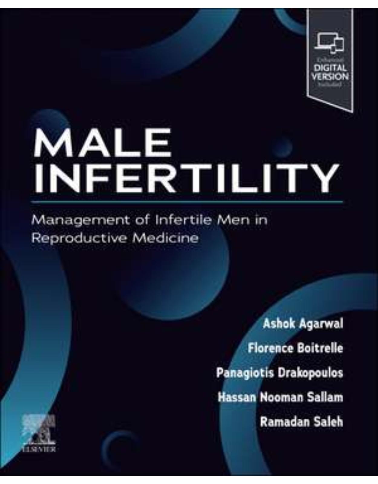 Male Infertility, 1st Edition