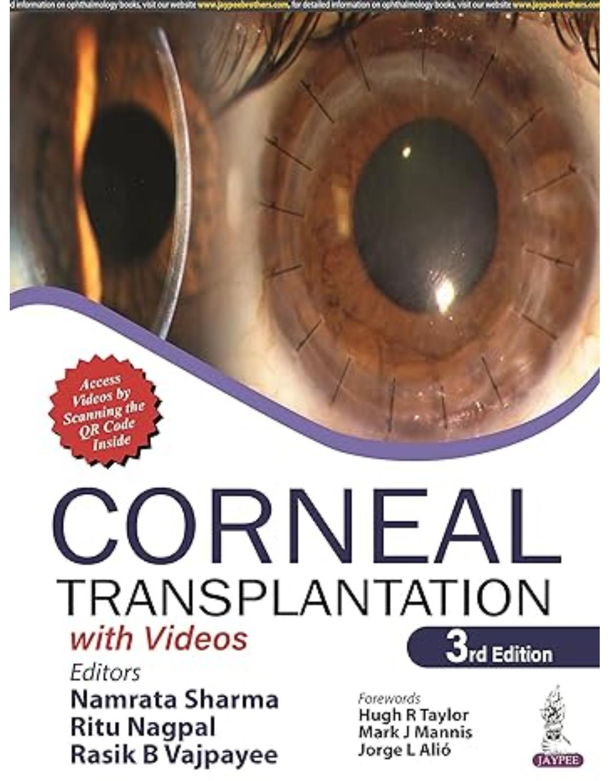  Corneal Transplantation