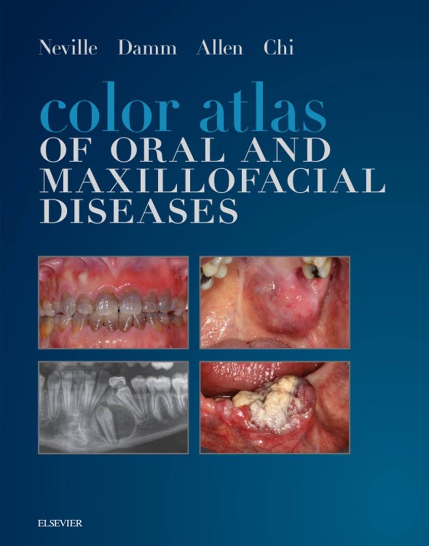 Coperta cărții "Color Atlas of Oral and Maxillofacial Diseases, 1e" de autor necunoscut