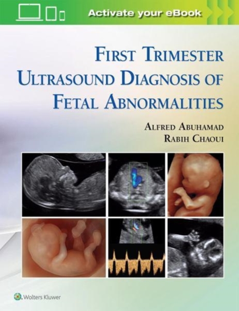 Coperta cărții "First Trimester Ultrasound Diagnosis of Fetal Abnormalities" de autor necunoscut