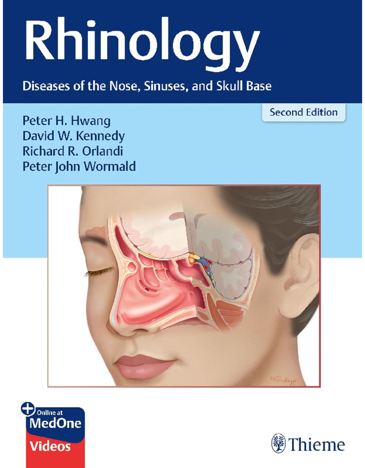 Rhinology: Diseases of the Nose, Sinuses, and Skull Base 