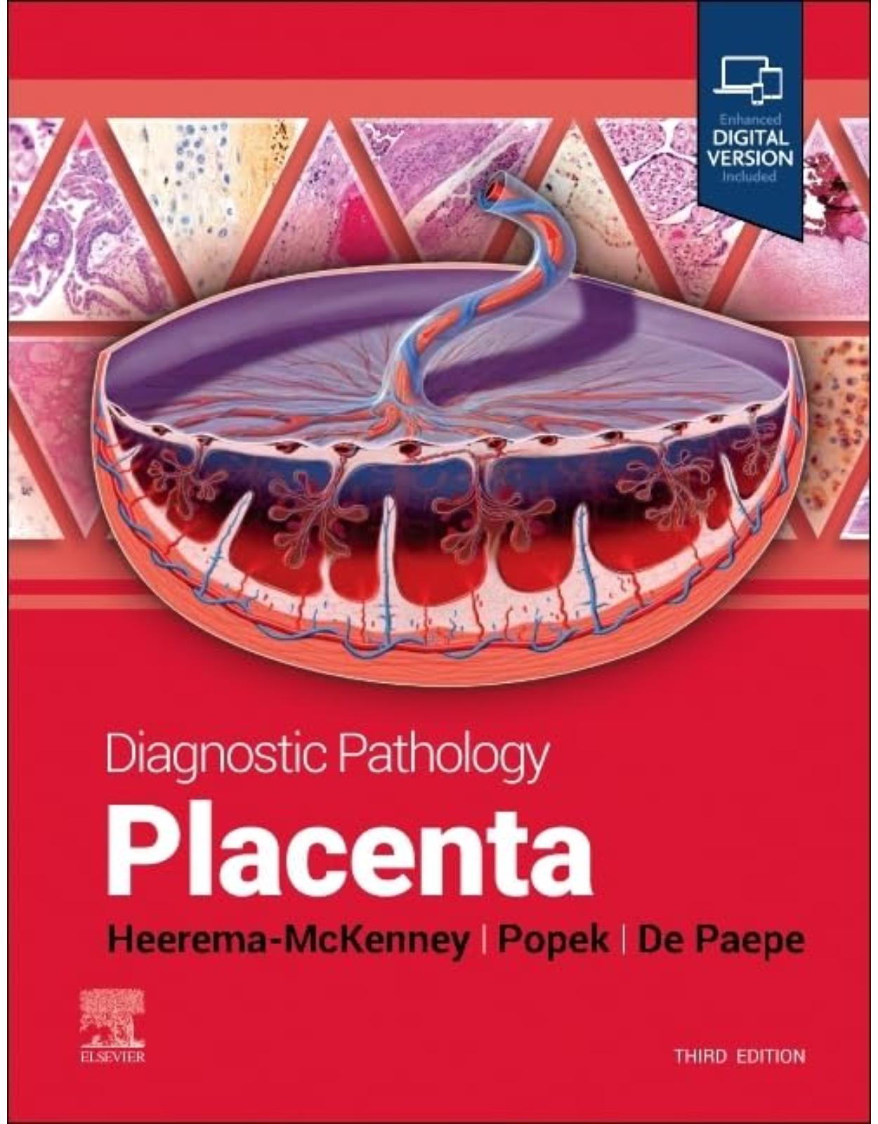 Diagnostic Pathology: Placenta, 3e