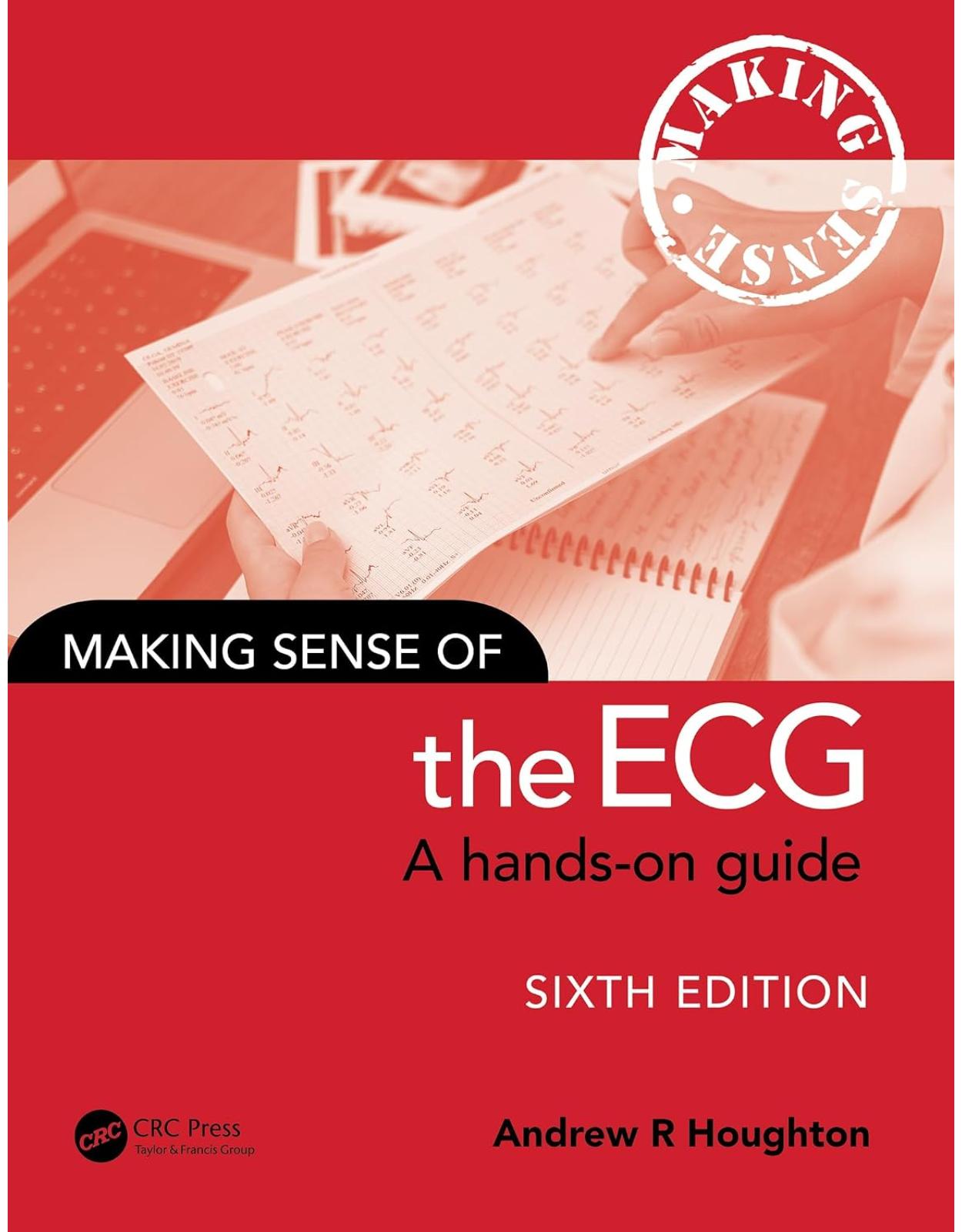 Making Sense of the ECG: A Hands-On Guide