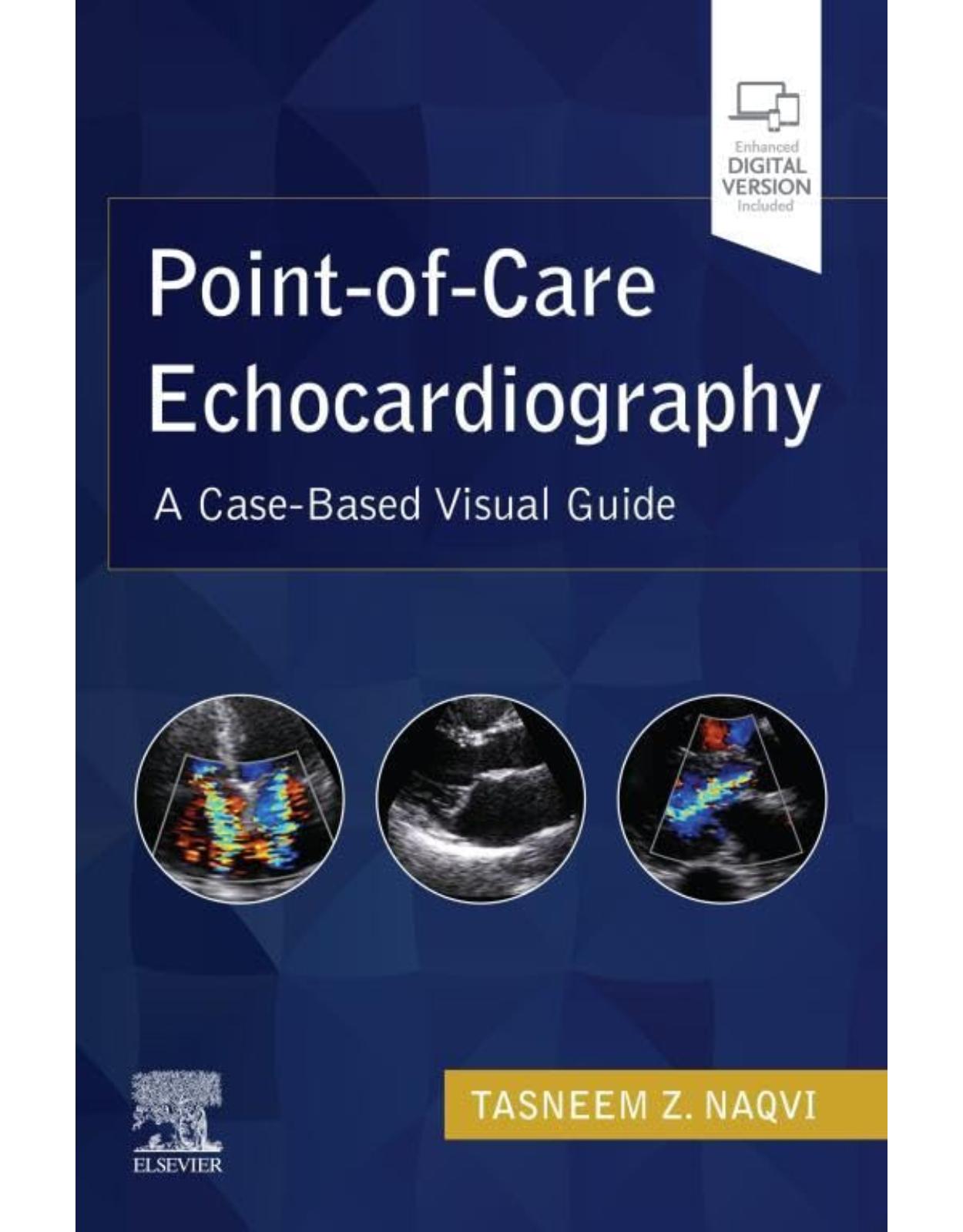 Point-of-Care Echocardiography: A Clinical Case-Based Visual Guide 