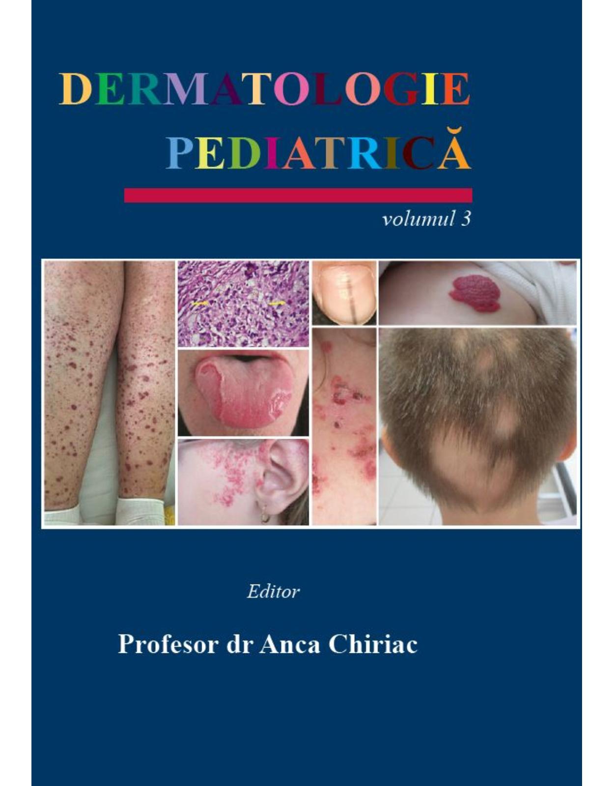 Pachet Dermatologie Pediatrica (Vol. 1-4)  Tratat complet de dermatologie pediatrica | Anca Chiriac