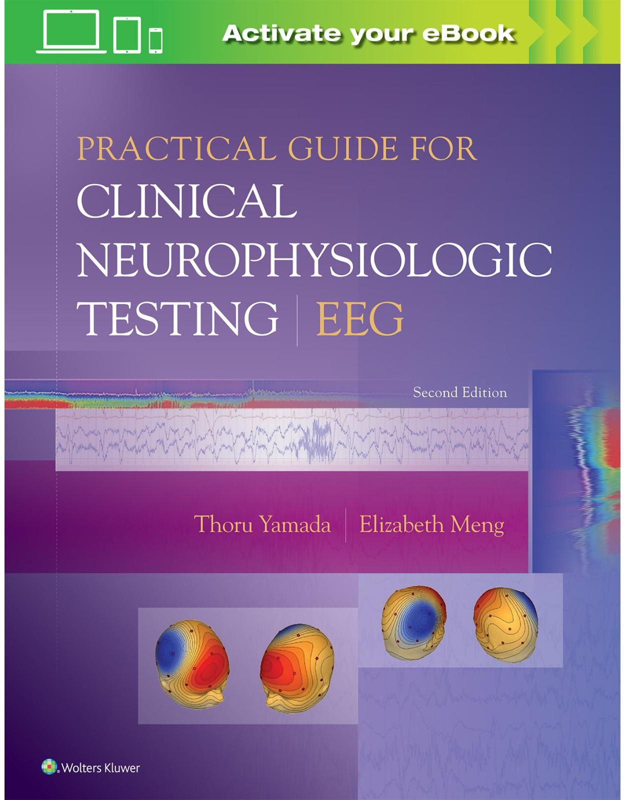Practical Guide for Clinical Neurophysiologic Testing: EEG