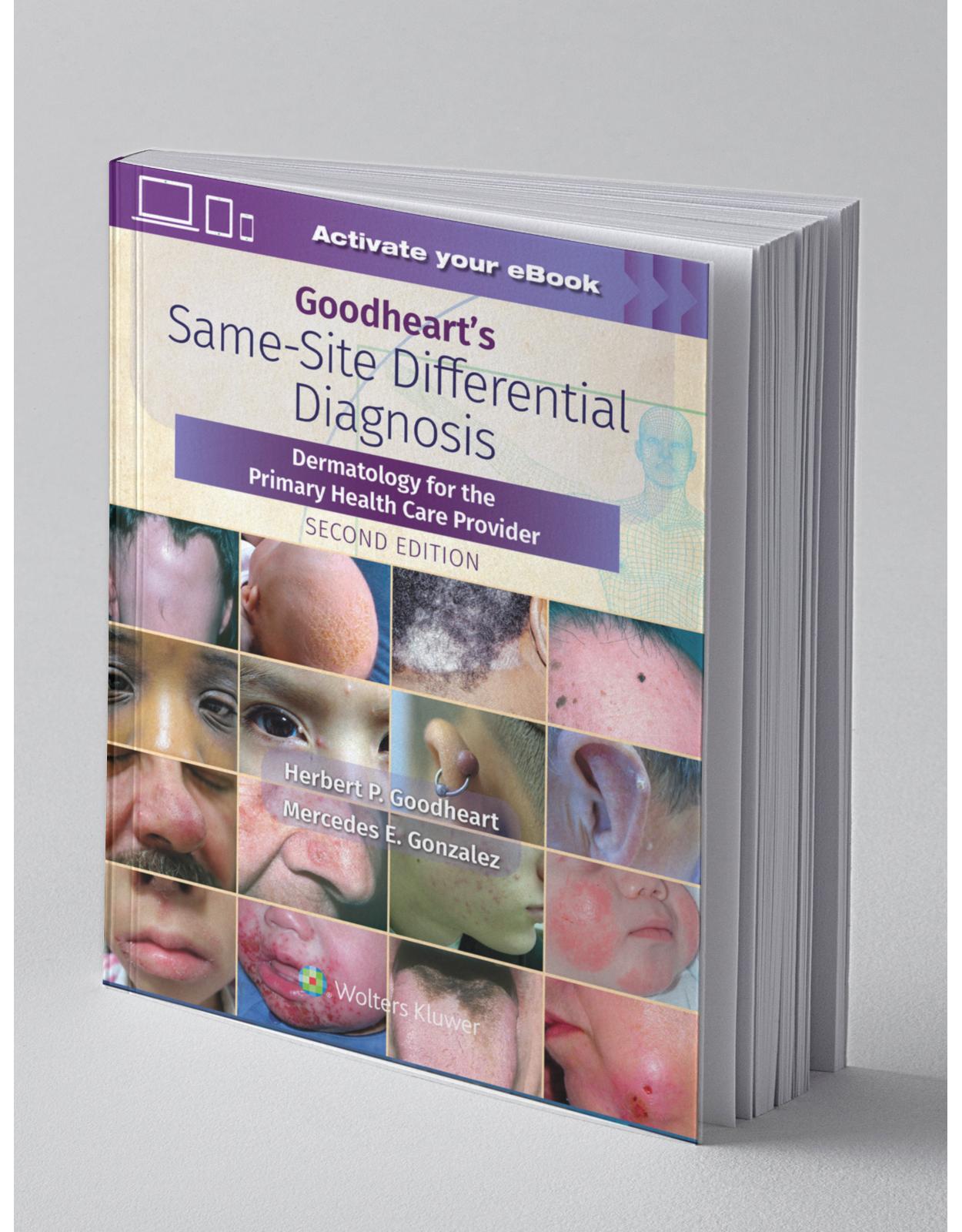 Goodheart’s Same-Site Differential Diagnosis Dermatology for the Primary Health Care Provider, Second edition