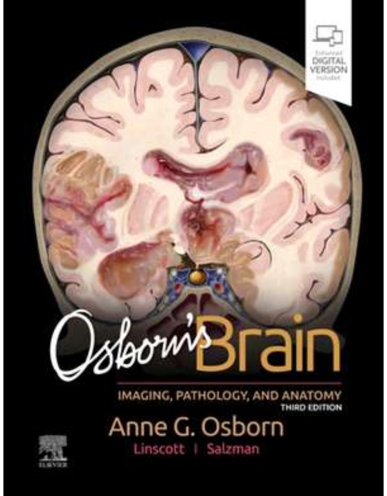 Osborn’s Brain, 3rd Edition