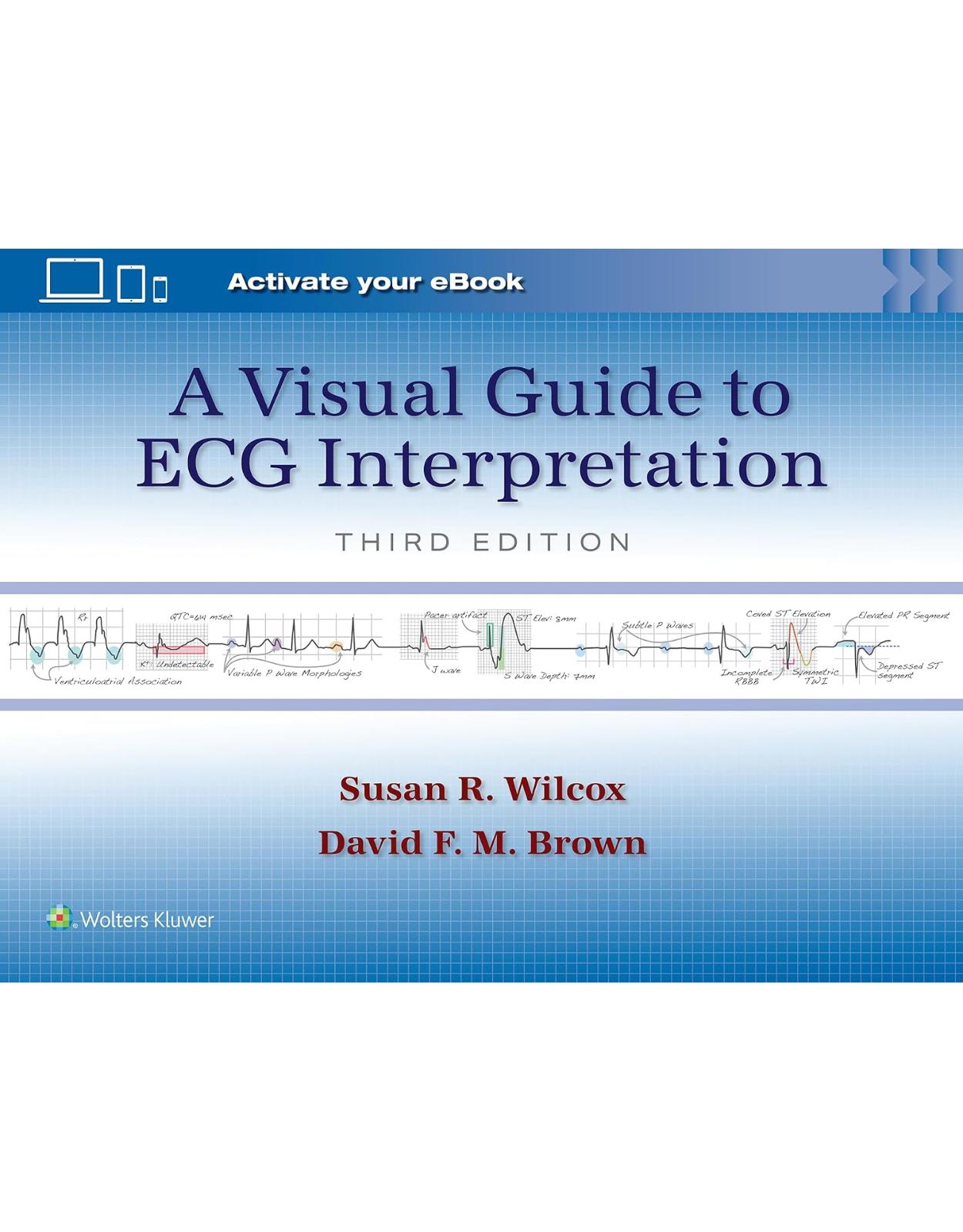 A Visual Guide to ECG Interpretation