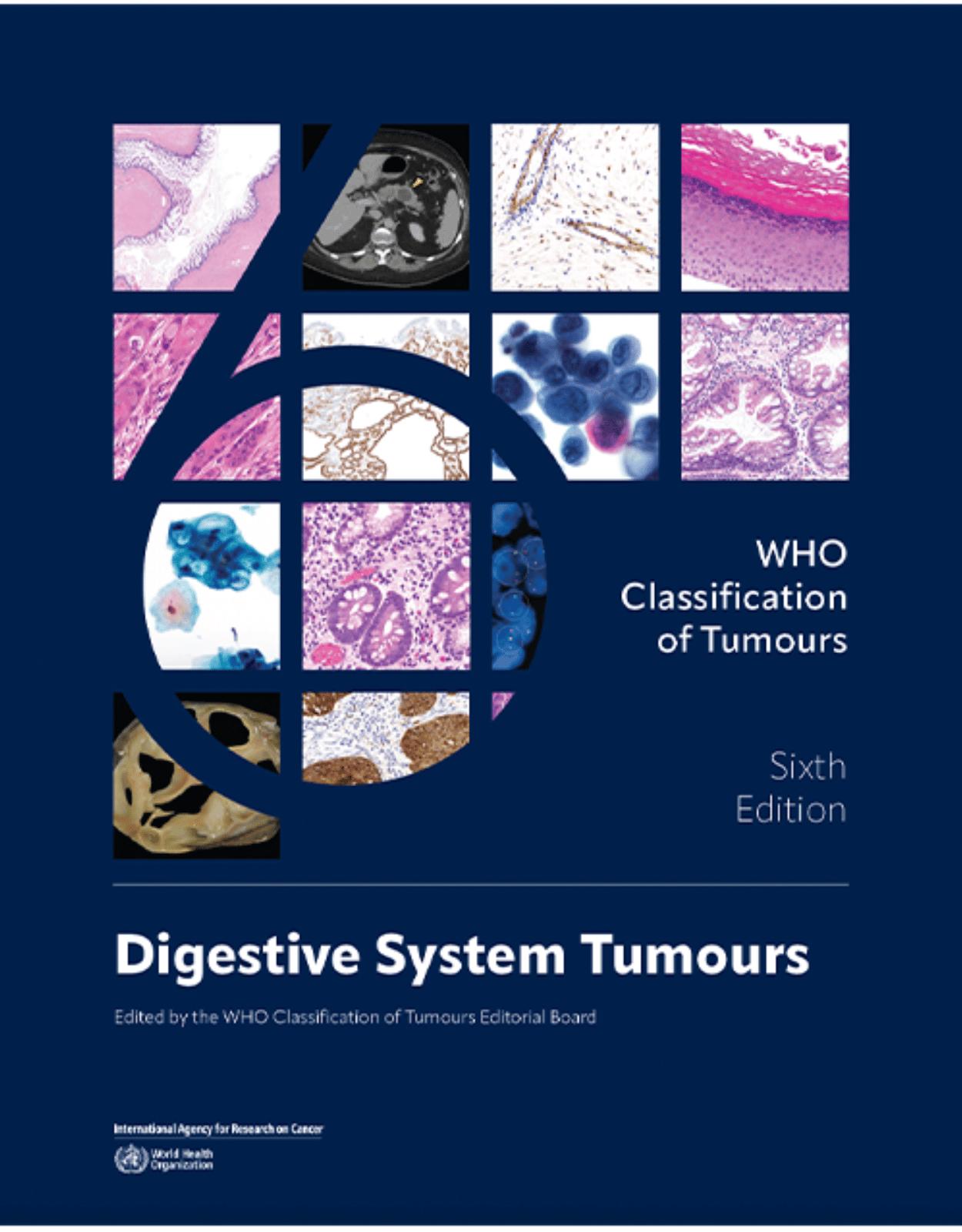 Digestive System Tumours. WHO Classification of Tumours, 6th Edition, Volume 1