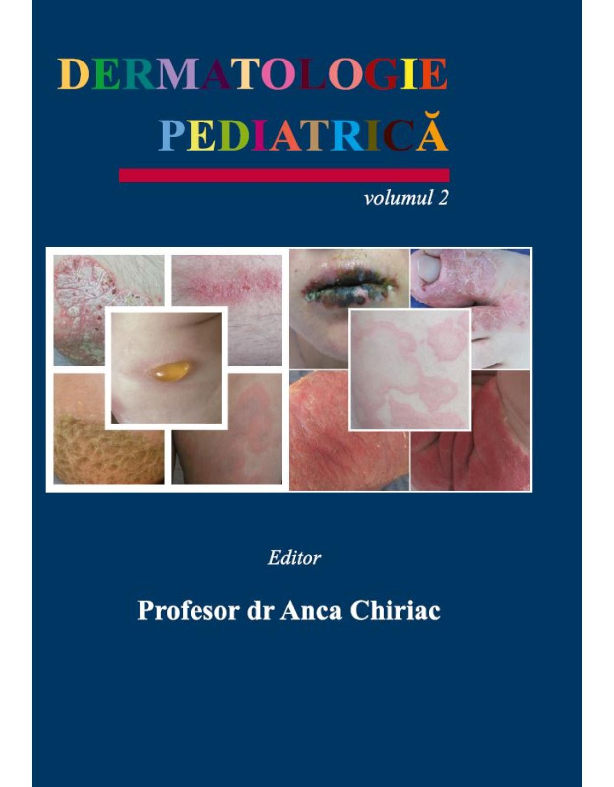 Pachet Dermatologie Pediatrica (Vol. 1-4)  Tratat complet de dermatologie pediatrica | Anca Chiriac